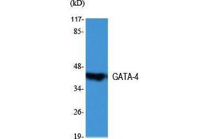 Western Blot (WB) analysis of specific cells using GATA-4 Polyclonal Antibody. (GATA4 抗体  (Internal Region))