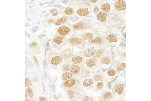 Immunohistochemistry (IHC) image for anti-SR-Related CTD-Associated Factor 11 (SCAF11) (C-Term) antibody (ABIN7448793)