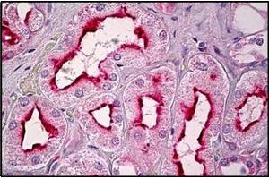 Human Kidney, Tubules: Formalin-Fixed, Paraffin-Embedded (FFPE) (GPR101 抗体  (C-Term))