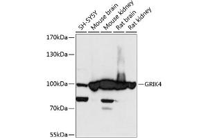 Western blot analysis of extracts of various cell lines, using GRIK4 antibody (ABIN6127977, ABIN6141396, ABIN6141397 and ABIN6217924) at 1:3000 dilution. (GRIK4 抗体  (AA 21-220))