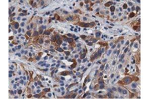 Image no. 2 for anti-Transforming, Acidic Coiled-Coil Containing Protein 3 (TACC3) antibody (ABIN1498095) (TACC3 抗体)