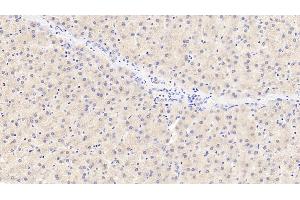 Detection of TYR in Porcine Liver Tissue using Polyclonal Antibody to Tyrosinase (TYR) (TYR 抗体  (AA 5-245))