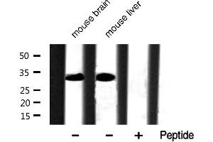 Western blot analysis of extracts of various tissue sample,using Phospho-Caspase 3 (Ser150) Antibody . (Caspase 3 抗体  (pSer150))