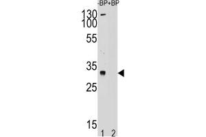 Western Blotting (WB) image for anti-Testis Specific Protein, Y-Linked 1 (TSPY1) antibody (ABIN2995165) (TSPY1 抗体)