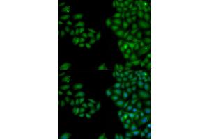 Immunofluorescence analysis of HeLa cells using NEFL antibody. (NEFL 抗体)