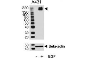 Western Blotting (WB) image for anti-Receptor tyrosine-protein kinase erbB-2 (ErbB2/Her2) (pTyr1140) antibody (ABIN3029502)