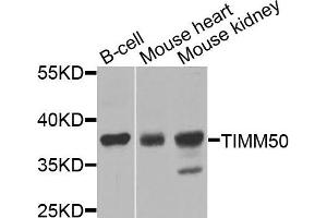 Western blot analysis of extracts of various cells, using TIMM50 antibody. (TIMM50 抗体)
