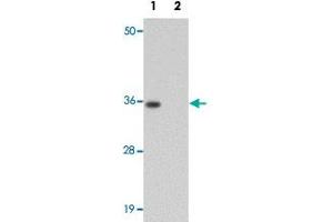 Western blot analysis of rat brain tissue with SYNGR1 polyclonal antibody  at 1 ug/mL in (Lane 1) the absence and (Lane 2) the presence of blocking peptide. (Synaptogyrin 1 抗体)