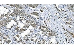 IHC analysis of eRF1/ETF1 using anti-eRF1/ETF1 antibody (ABIN7602625).