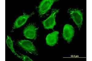 Immunofluorescence of monoclonal antibody to CALM2 on HeLa cell. (Calmodulin 2 抗体  (AA 1-149))