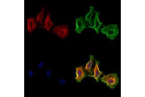 ABIN6266014 and ABIN6273185 staining Hela cells by IF/ICC. (WBP2NL 抗体  (Internal Region))