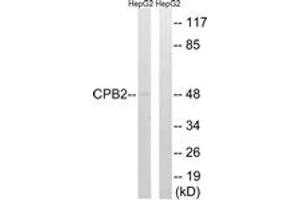 Western blot analysis of extracts from HepG2 cells, using CPB2 Antibody. (CPB2 抗体  (AA 321-370))