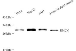 Western blot analysis of EMCN (ABIN7073818) at dilution of 1: 500 (Endomucin 抗体)