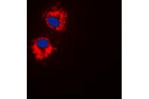 Immunofluorescent analysis of EG5 (pT926) staining in HepG2 cells. (KIF11 抗体  (C-Term, pSer926))