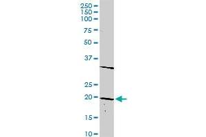 DLX6 MaxPab rabbit polyclonal antibody. (DLX6 抗体  (AA 1-175))