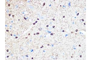 Immunohistochemistry (IHC) image for anti-Stathmin 1 (STMN1) antibody (ABIN1678518)