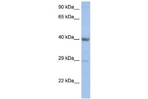 WB Suggested Anti-ZNF474 Antibody Titration: 0. (ZNF474 抗体  (Middle Region))