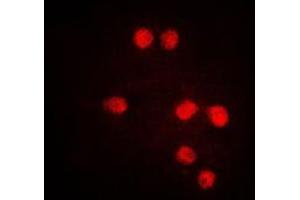 Immunofluorescent analysis of TEL staining in Jurkat cells. (ETV6 抗体  (C-Term))