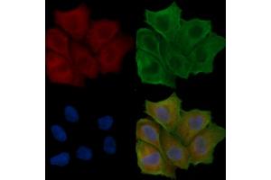 ABIN6258916 and ABIN6275149 staining Hela cells(24h of starvation treatment) by IF/ICC. (GJB7 抗体  (C-Term))