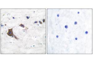 Immunohistochemistry (IHC) image for anti-Hydroxysteroid (17-Beta) Dehydrogenase 10 (HSD17B10) (Internal Region) antibody (ABIN1848526) (HSD17B10 抗体  (Internal Region))