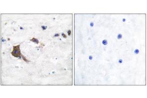Immunohistochemistry (IHC) image for anti-Hydroxysteroid (17-Beta) Dehydrogenase 10 (HSD17B10) (Internal Region) antibody (ABIN1848526)