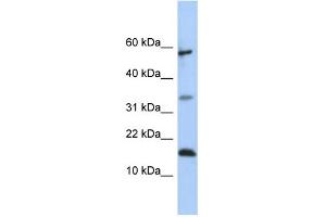 WB Suggested Anti-LCN6 Antibody Titration:  0. (LCN6 抗体  (Middle Region))