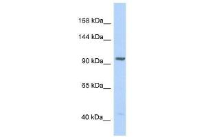 Western Blot showing IDE antibody used at a concentration of 1. (IDE 抗体  (N-Term))
