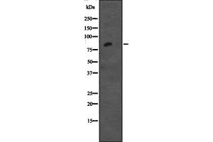 Western blot analysis of CDH12 expression in Jurkat cell lysate,The lane on the left is treated with the antigen-specific peptide. (Cadherin 12 抗体  (Internal Region))
