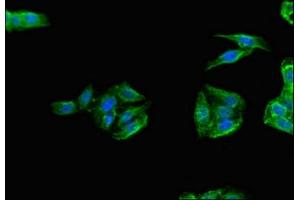 Immunofluorescent analysis of HepG2 cells using ABIN7172328 at dilution of 1:100 and Alexa Fluor 488-congugated AffiniPure Goat Anti-Rabbit IgG(H+L) (TANK 抗体  (AA 4-98))