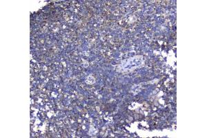 Immunohistochemistry (IHC) image for anti-Synaptotagmin I (SYT1) antibody (ABIN5647273)