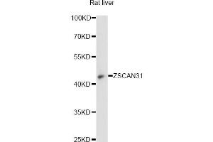 Western blot analysis of extracts of rat liver, using ZSCAN31 antibody (ABIN6294106) at 1:3000 dilution. (ZKSCAN2 抗体)