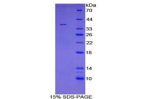 SDS-PAGE analysis of Mouse TATA Binding Protein. (TBP 蛋白)