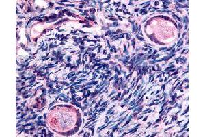 Immunohistochemical (Formalin/PFA-fixed paraffin-embedded sections) staining in human ovary (oocytes) with TMEM5 polyclonal antibody . (TMEM5 抗体)