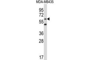 Western Blotting (WB) image for anti-Zinc Finger Protein 479 (ZNF479) antibody (ABIN5017203) (ZNF479 抗体)