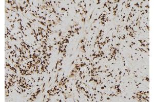 ABIN6272431 at 1/100 staining Human gastric tissue by IHC-P.