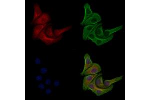 Phospho-PI3K p85 beta (Ser605) Antibody staining Hela cells(heat shock treatment) by IF/ICC. (PIK3R2 抗体  (pSer605))