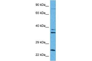 Western Blotting (WB) image for anti-Carnitine Palmitoyltransferase 1A (Liver) (CPT1A) (Middle Region) antibody (ABIN2782010)