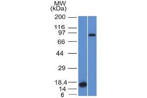 Western blot testing of 1) partial human recombinant protein and 2) human HeLa lysate with Factor XIIIa antibody (clone F13A1/1448). (F13A1 抗体  (AA 46-181))