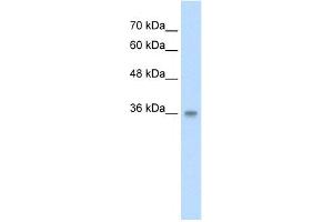 WB Suggested Anti-PP2447 Antibody Titration:  2. (TRABD 抗体  (N-Term))