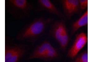 Immunofluorescence staining of methanol-fixed Hela cells using MARCKS(Phospho-Ser162) Antibody. (MARCKS 抗体  (pSer162))