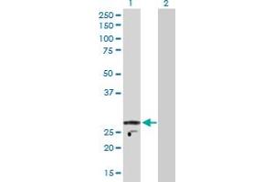 Western Blot analysis of KCNIP2 expression in transfected 293T cell line by KCNIP2 MaxPab polyclonal antibody. (KCNIP2 抗体  (AA 1-270))
