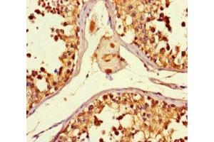 Immunohistochemistry of paraffin-embedded human testis tissue using ABIN7160774 at dilution of 1:100 (SMYD2A 抗体  (AA 115-272))