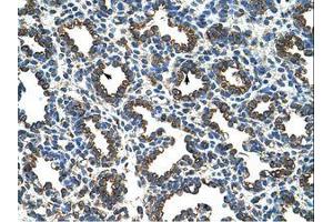 Image no. 1 for anti-Ribosomal Protein L8 (RPL8) (AA 155-204) antibody (ABIN203299) (RPL8 抗体  (AA 155-204))