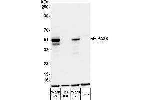 Western Blotting (WB) image for anti-Paired Box 8 (PAX8) (AA 225-275) antibody (ABIN7795777)