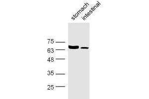 Western Blotting (WB) image for anti-Solute Carrier Family 6 (Neurotransmitter Transporter, GABA), Member 11 (SLC6A11) (AA 531-632) antibody (ABIN1713800)