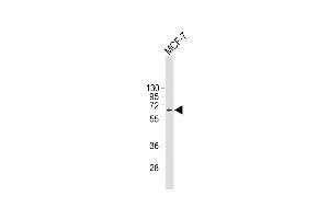 Western Blotting (WB) image for anti-Mdm2, p53 E3 Ubiquitin Protein Ligase Homolog (Mouse) (MDM2) (AA 196-435) antibody (ABIN6244151)