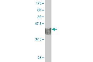 Western Blot detection against Immunogen (35. (STK40 抗体  (AA 349-434))