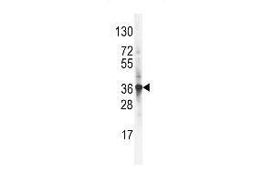 Western Blotting (WB) image for anti-Low Density Lipoprotein Receptor Adaptor Protein 1 (LDLRAP1) (AA 277-306), (C-Term) antibody (ABIN392554)