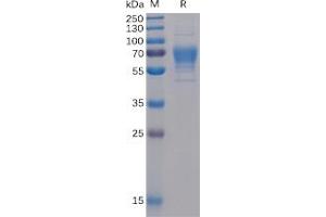 Human CD30 Ligand Protein, mFc-His Tag on SDS-PAGE under reducing condition. (TNFSF8 Protein (mFc-His Tag))
