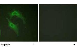 Immunofluorescence analysis of HeLa cells, using CD226 polyclonal antibody . (CD226 抗体  (Ser329))